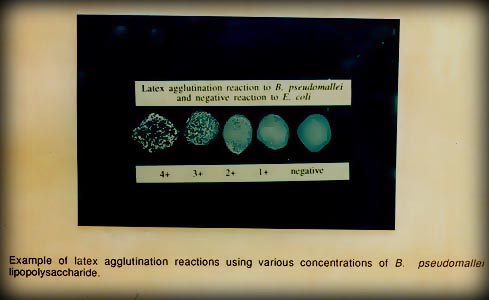 https://www.google.com.my/search?client=firefox-a&rls=org.mozilla:en-US:official&q=latex+agglutination+burkholderia+pseudomallei&bav=on.2,or.r_qf.&bvm=bv.48175248,d.bmk&biw=1366&bih=543&um=1&ie=UTF-8&hl=en&tbm=isch&source=og&sa=N&tab=wi&ei=IvrCUdCqEMHRrQexmIHoCA#facrc=_&imgdii=_&imgrc=Ui0KOL8vEsb0_M%3A%3B_Y2yVnQpu7SBRM%3Bhttp%253A%252F%252Feverest.bic.nus.edu.sg%252Fpj%252Fbm%252Fupload%252Flimjiajia%252FPic7.jpg%3Bhttp%253A%252F%252Feverest.bic.nus.edu.sg%252Fpj%252Fbm%252Fupload%252Flimjiajia%252Fintroduction.htm%3B489%3B300